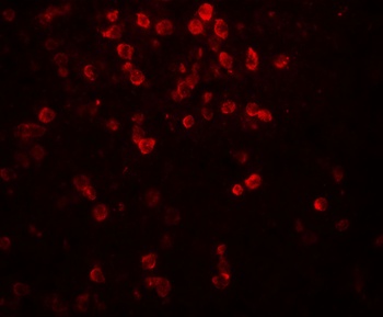 IL-9 Antibody