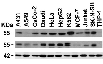 IRAK-4 Antibody