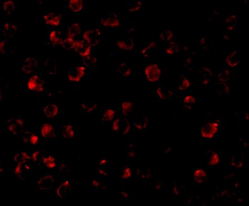 IRAK-4 Antibody