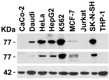 IRAK Antibody