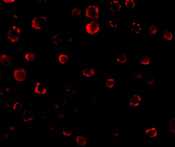 IRAK Antibody