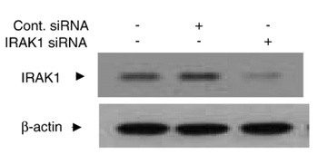 IRAK Antibody