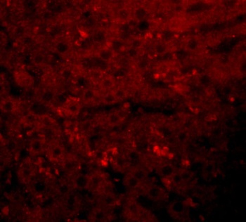 KDM3A Antibody