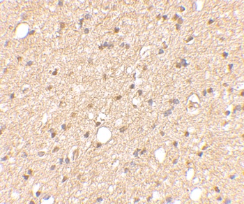 LGI2 Antibody