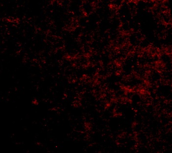 LGI2 Antibody