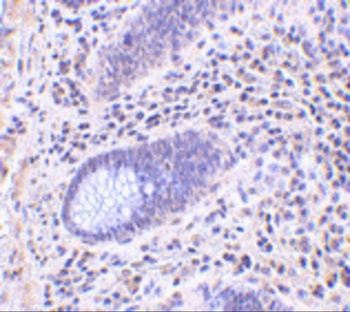 LRRC1 Antibody