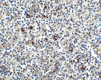 MD-2 Antibody