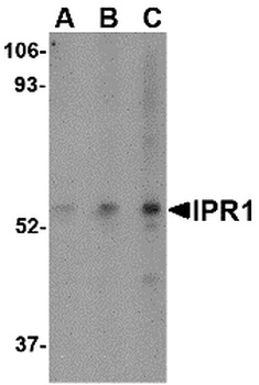 SP110 Antibody