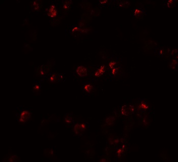 IL-22 Antibody