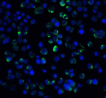 IL-21 Receptor Antibody