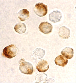 IKBKB Antibody