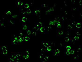 IKBKB Antibody