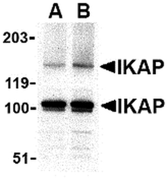 IKBKAP Antibody