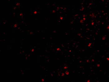 IKBKAP Antibody
