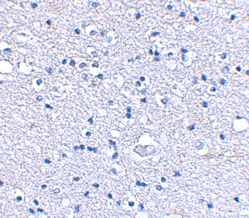 GRIK4 Antibody