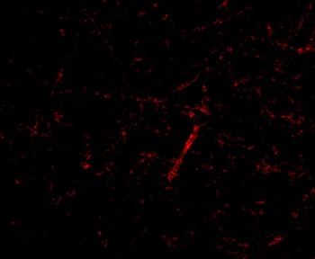 GRIK4 Antibody