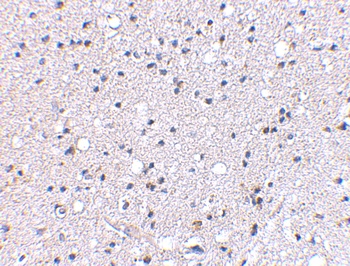 GRIK4 Antibody