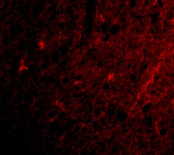 GRIK1 Antibody