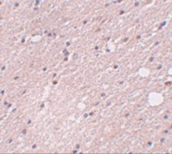 FRMPD4 Antibody