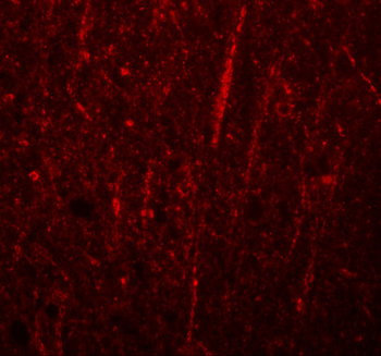 FRMPD4 Antibody