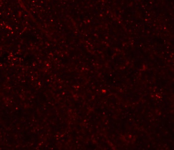 FRMPD3 Antibody