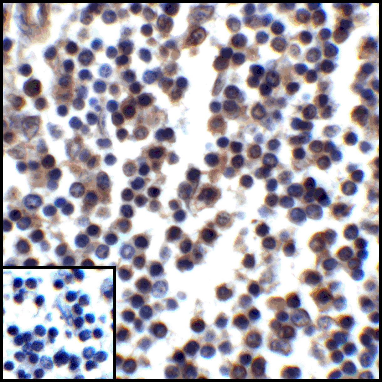 PDL1 Antibody [8E12]