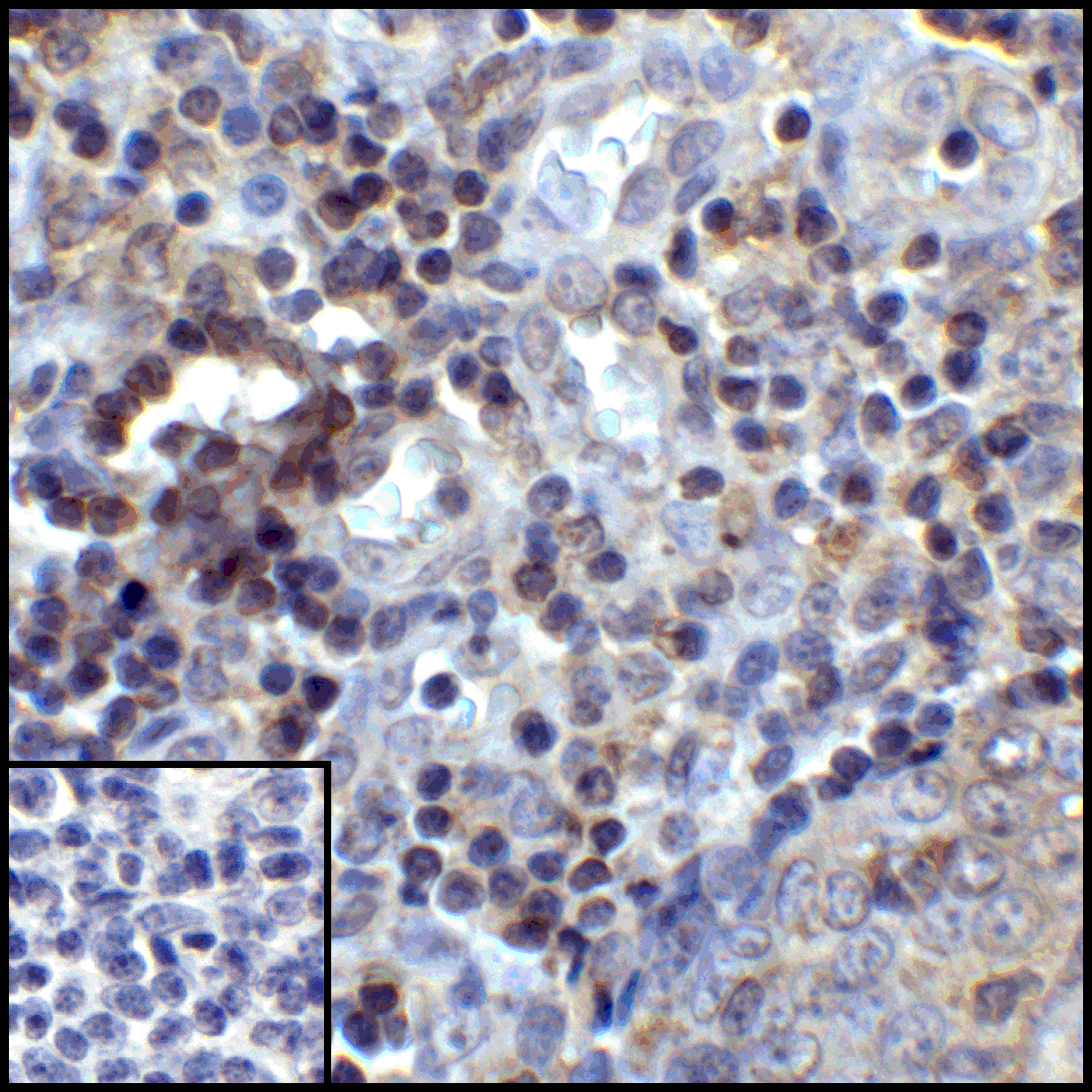 PDL1 Antibody [8E12]