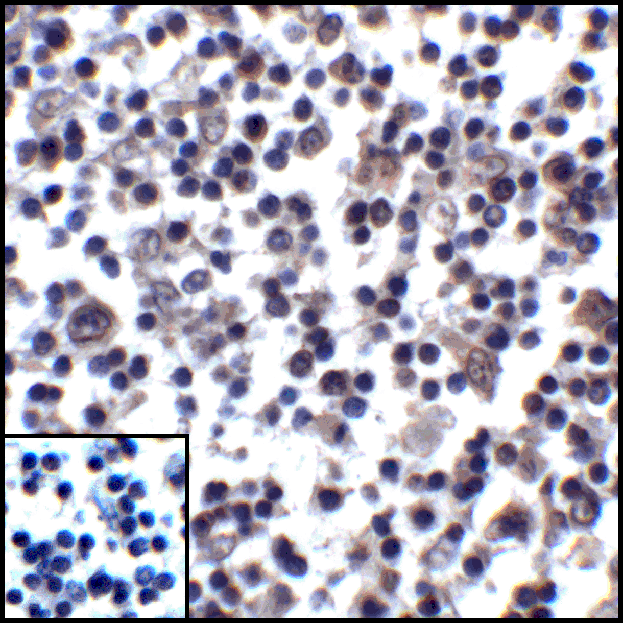 PDL1 Antibody [1D7]