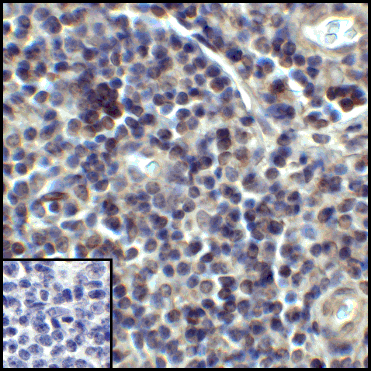 PDL1 Antibody [1D7]