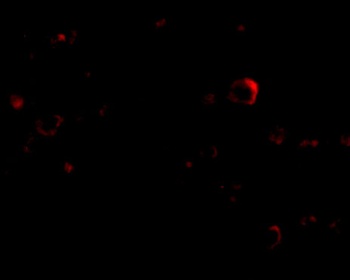 TMC8 Antibody