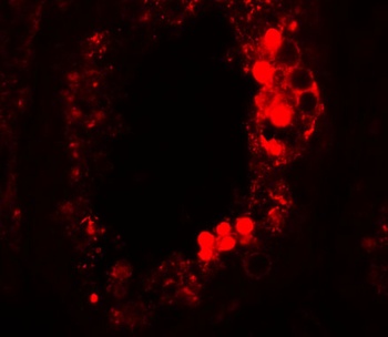 ESX1 Antibody