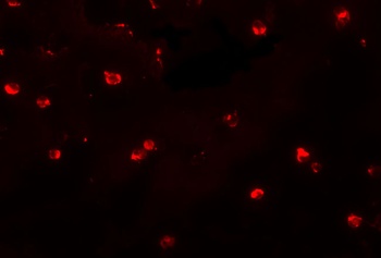 KLHL25 Antibody