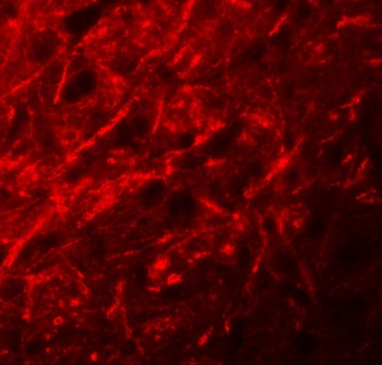 CTNNBL1 Antibody