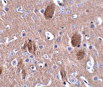 CDIP1 Antibody