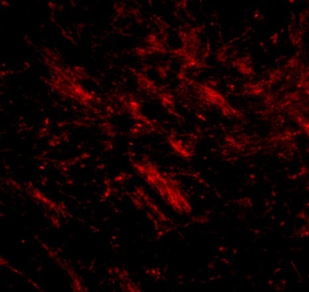 CDIP1 Antibody
