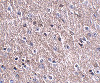 CDIP1 Antibody