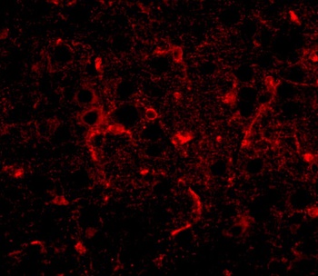 CDIP1 Antibody
