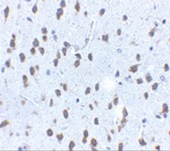 KITLG Antibody