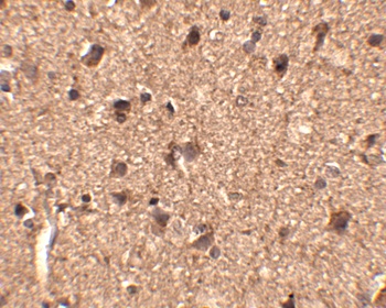 SLITRK1 Antibody