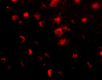 SLITRK1 Antibody