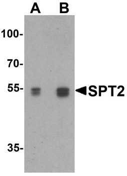 SPTLC2 Antibody