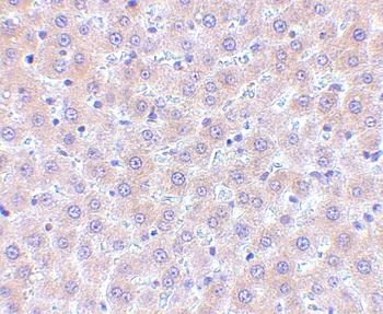TNFSF11 Antibody