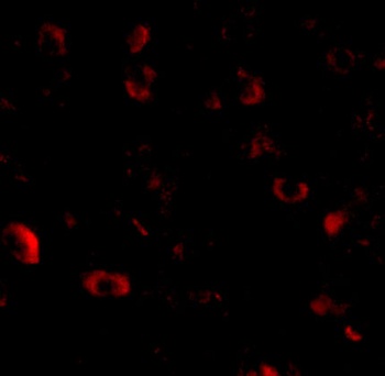 CADPS Antibody