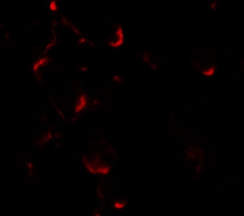 BCL2L11 Antibody