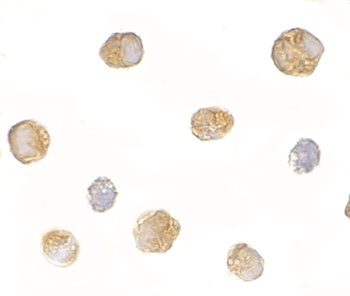 BICD1 Antibody