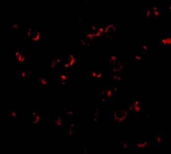 BICD1 Antibody