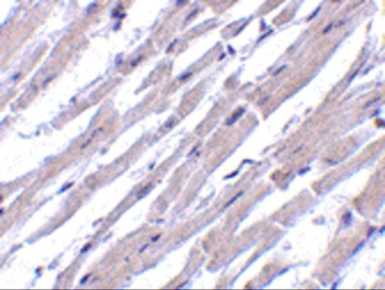 BCL2L13 Antibody