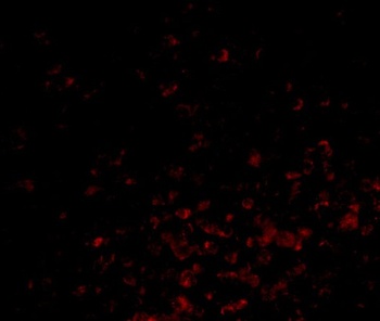 BAG1 Antibody