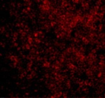 BAD Antibody