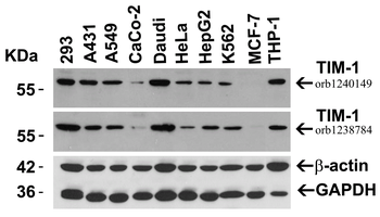 HAVCR1 Antibody